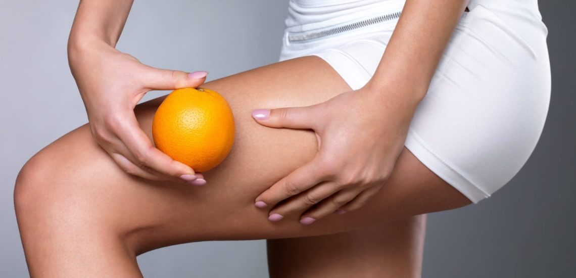 cellulite-11